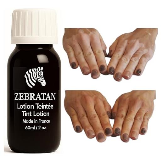 Zebratan trucco vitiligine su misura Zebratan - 60 ml marrone medio - lozione autoabbronzante - non grassa, non un fondotinta - mimetico piastre