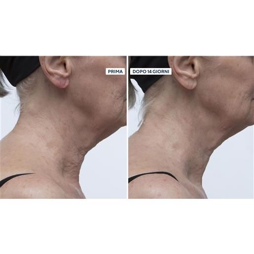 Perricone MD kit 2 creme neuropeptide collo e décolleté